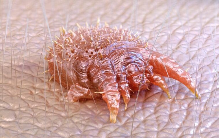Primo piano di un acaro della scabbia ingrandito al microscopio, poggiato sulla superficie della pelle umana.